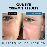Under Eye Cream for Dark Circles & Puffiness - Eclat