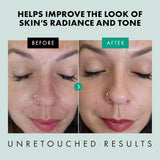 Organic Niacinamide Serum