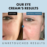 Under Eye Cream for Dark Circles & Puffiness