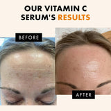 Brightening Vitamin C Serum