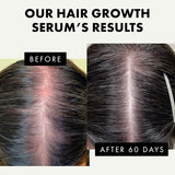 Biotin Oil Hair Growth Serum
