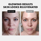 Vitamin C, Retinol, Hyaluronic Acid - 3 Pack Face Care Set - Eclat