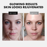 Vitamin C & Retinol Serum for Face - 2 Pack - Eclat